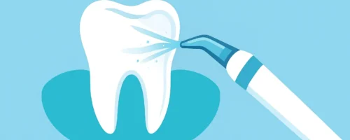 professionelle Zahnreinigung, Air-Flow, Fluoridierung, Mundschutz