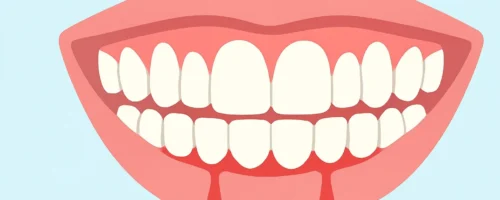 Zahnfleischbluten: Periimplantitis, Parodontitis oder Gingivitis
